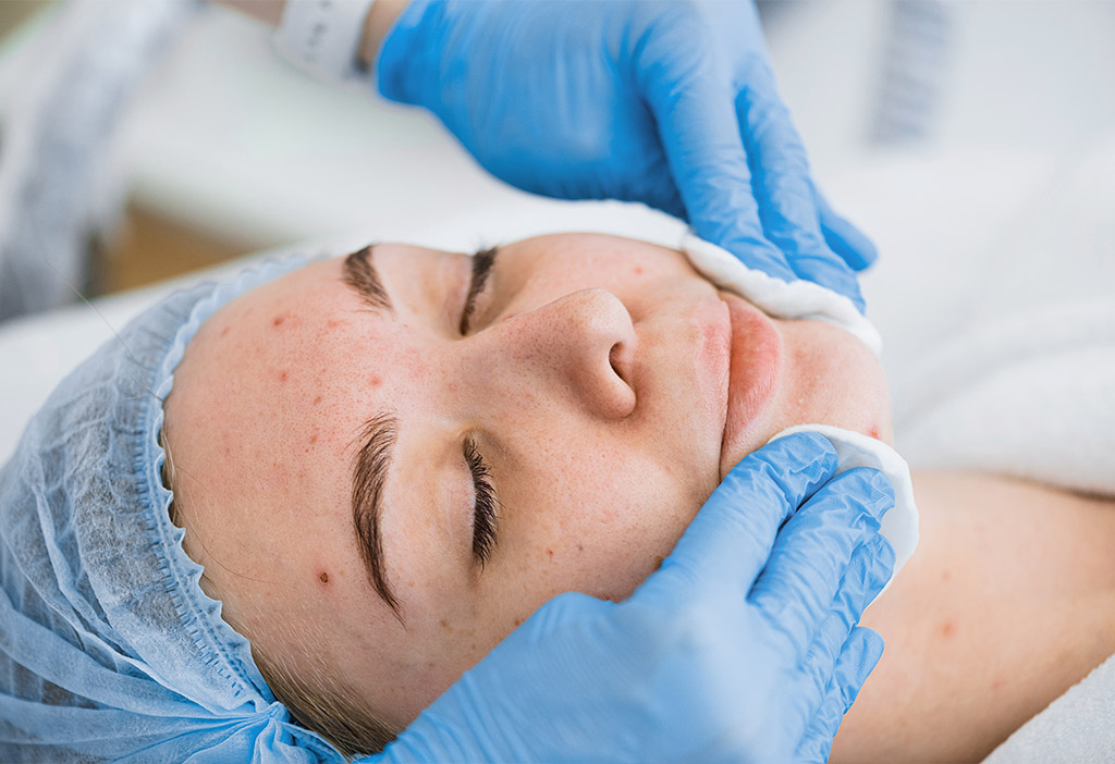 Acne Facial Treatment